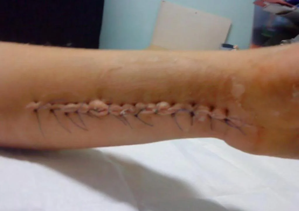 arm3.webp