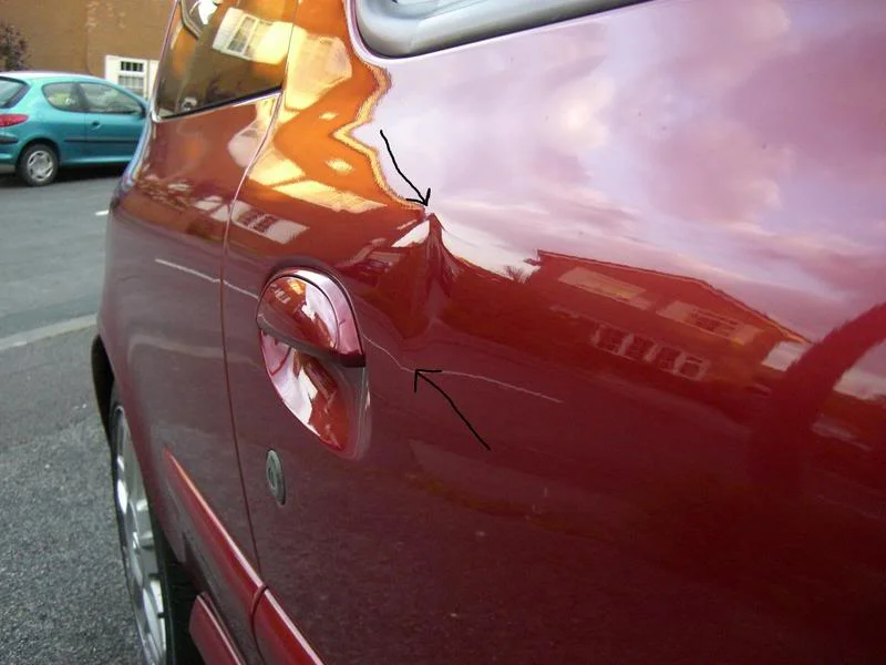 Dent.webp