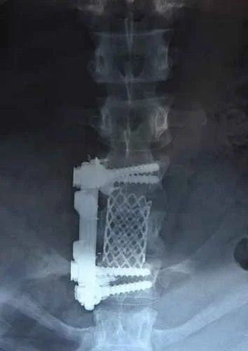 image-17.webp