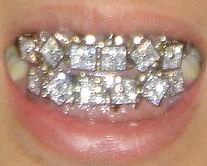 mouth-grilzz.webp