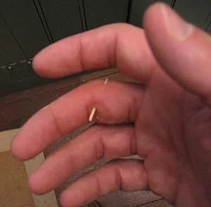 splinter.webp