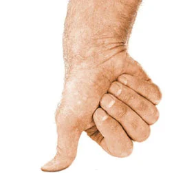 Under+the+thumb.webp