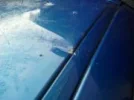 2nd dent.webp