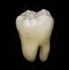 250px-Lower_wisdom_tooth.webp