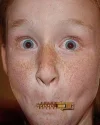 zipper-mouth.webp